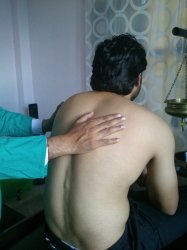 Ild-ayurvedic treatment
