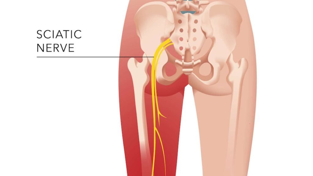 Ayurvedic Treatment for sciatica Disease
