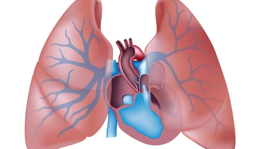 Pulmonary artery Hypertension